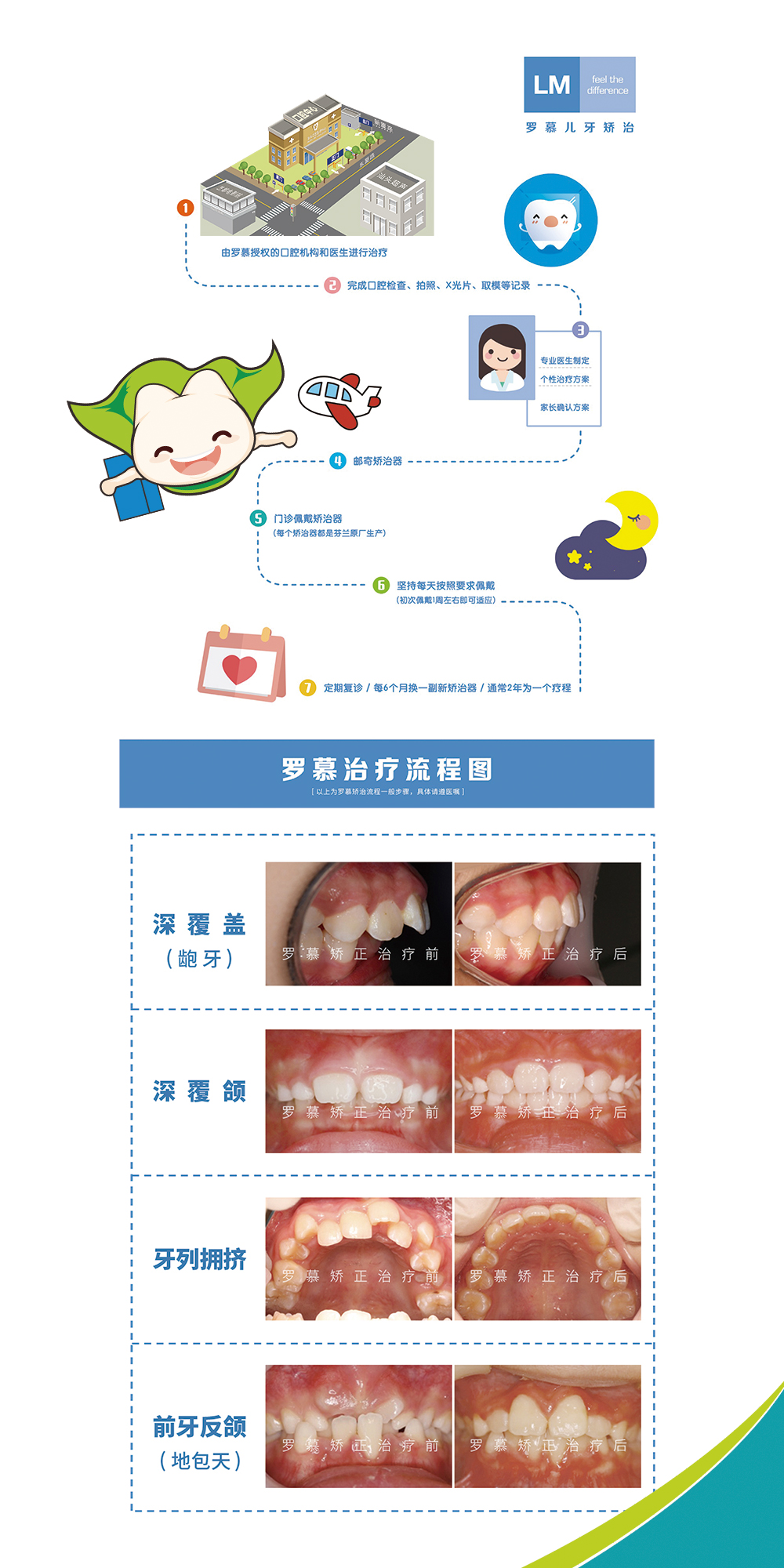 罗慕咬合诱导lmdental技术